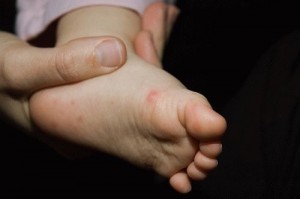вирус коксаки у детей