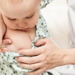 синдром рея у детей фото